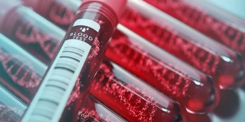 HD image of Blood sampples after Blood test