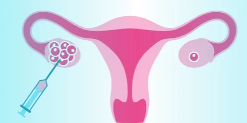 Diagramatic view of Egg-retrieval process